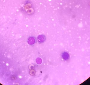 Een paar rondcelligen op een cytologie uitstrijkje